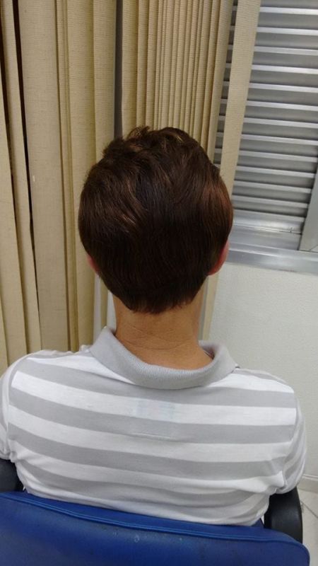 Onde Encontrar Perucas Naturais Masculinas no Jardim Piratininga - Perucas para Tratamento de Quimioterapia Onde Encontrar Perucas Naturais Masculinas no Jardim Piratininga - Perucas para Tratamento de Quimioterapia