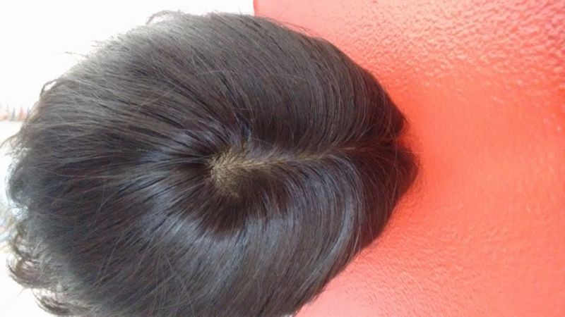 Peruca Natural Feminina no Sítio das Francas - Perucas para Tratamento de Quimioterapia Peruca Natural Feminina no Sítio das Francas - Perucas para Tratamento de Quimioterapia